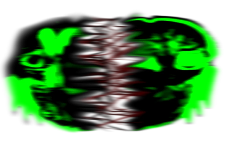 MRI-140 (Blood Warning) | Fandom