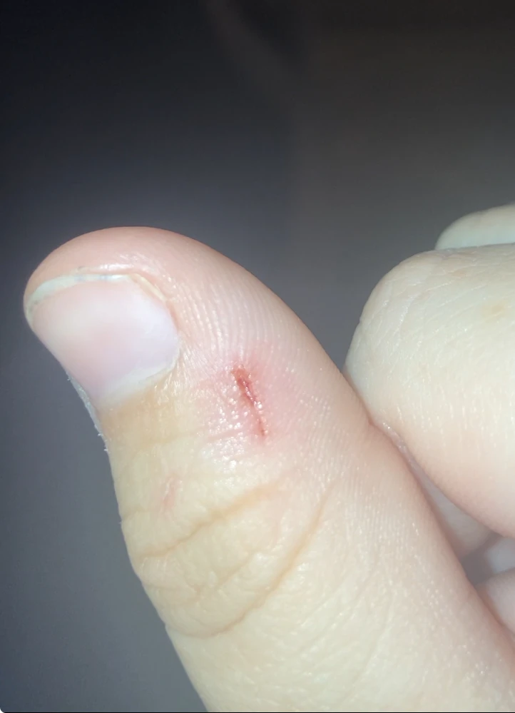 Somehow, I got cut twice on the same hand in one day from the same