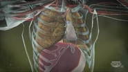 The end result of both gases damages the lungs...