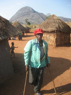  A  landmine victim.
