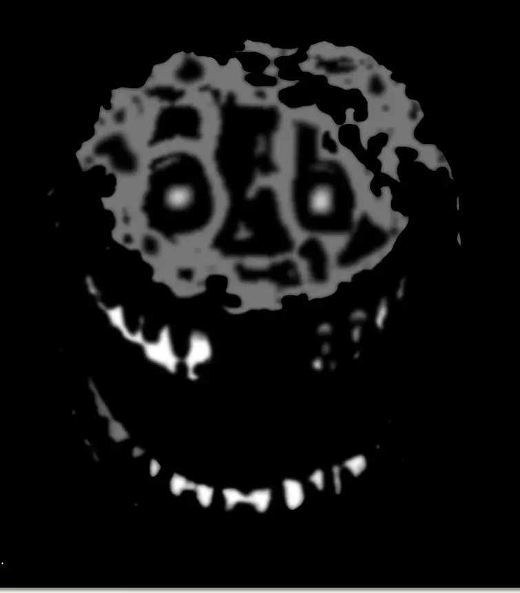 Rush is tired of people surviving the entities Fandom