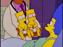 Bart and Hugo Conjoined - Treehouse of Horror VII