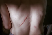 2x07 scar back