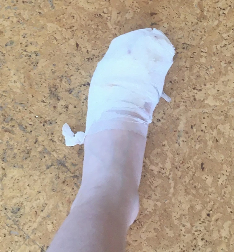 Stepped on some glass fucked up my toes Fandom