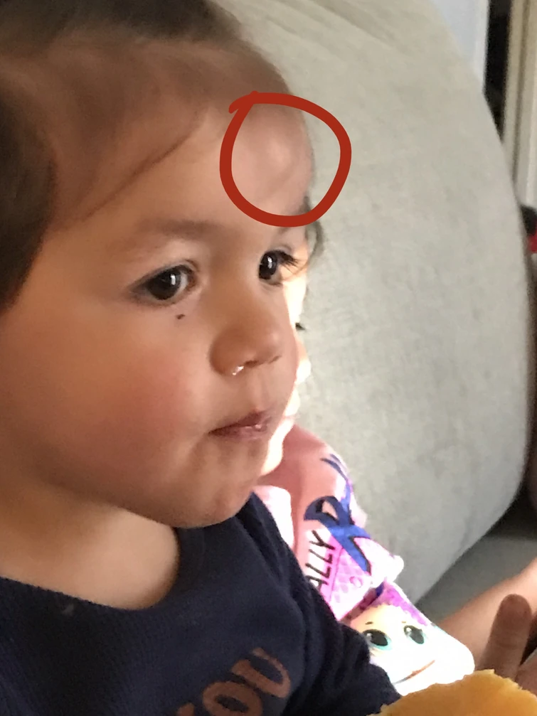 My brother hit his head on the floor and he’s starting to look like