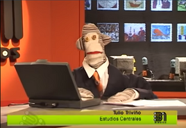 Tulio antes de la cirugía. Piloto (TVN)