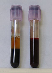 Blood in Test Tubes