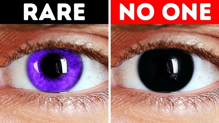 the rarest eye colors in humans