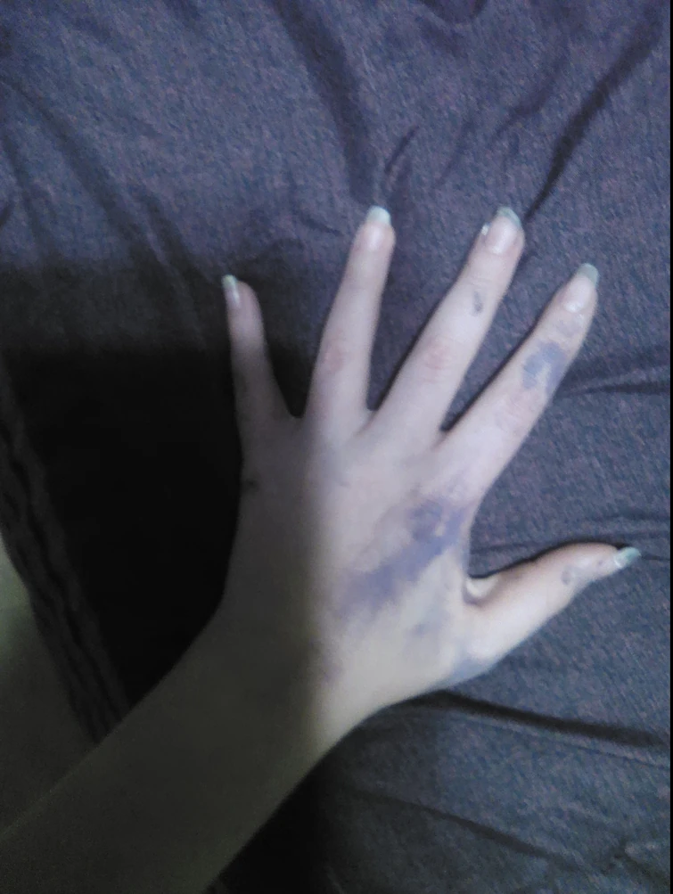 Hand/arm doodles from the last three days because yes Fandom