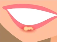 Caitlin has a cold sore (or "lip thingy," as she insists).