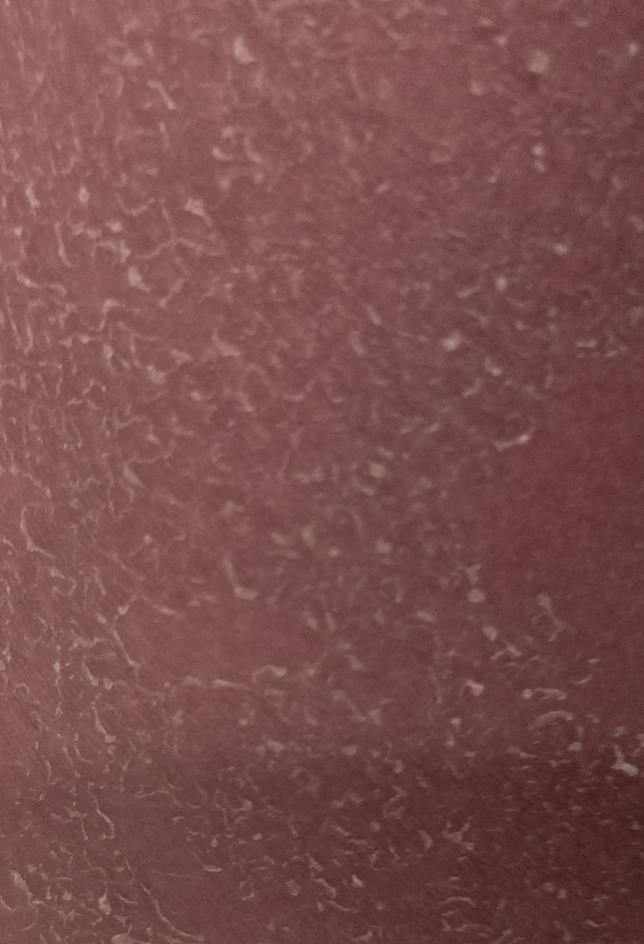 Why does my skin look like that 🤮🤮🤮🤮 Fandom