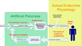 Artificial Pancreas