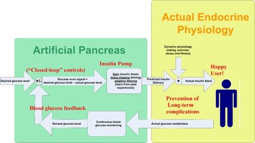 Artificial Pancreas