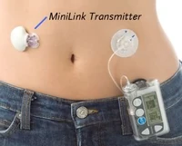 This Minimed CGMS transmits continuous BG values to their insulin pump, so far just to display BG values and trends.  Closing the loop is getting closer.