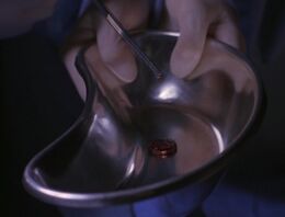 14-Implantat.jpg