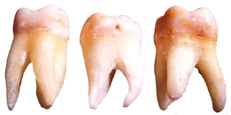 322676046117211.png (429 KB) 三颗脱落的牙齿。