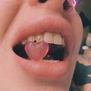 Teeth-implant-heart-pink