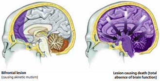 Neuro7