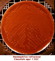 H.influenzae agar chocolate