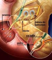 Pancreatite causas