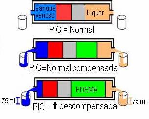 HIC 6