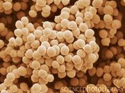 B2340182-Staphylococcus Saprophyticus-SPL-3-