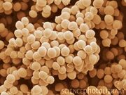 B2340182-Staphylococcus Saprophyticus-SPL-3-