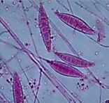 Microsporum