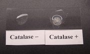 Catalase