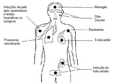 Pseudomonas