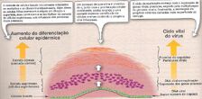 Verruga