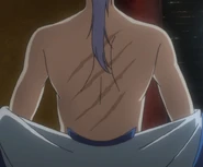 Kija's scars