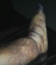 Main 01 clue bloated