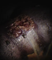 Previous murders strap marks