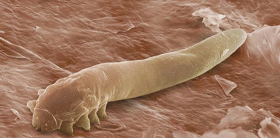 Demodex_folliculorum.jpg