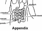 We Will Not Have Appendixes in the Future