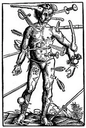 For some reason, Western acupuncture never really worked out