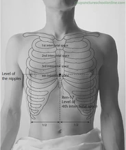 Ren-17-Chest-Centre-DANZHONG-Acupuncture-Points-1.jpg (128 КБ) Точка Шань-чжун Ren-17