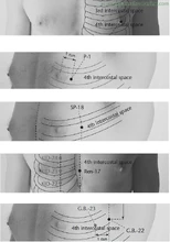 Ren-17-Chest-Centre-DANZHONG-Acupuncture-Points-2.jpg (141 КБ) Точка Шань-чжун Ren-17