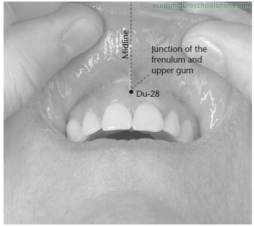 изменения / Поиск по тегам / Брекеты и брекет-системы Дневники брекетоносцев, от