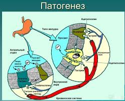 Патогенез