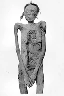Mummy Ahmose-Sitkamose Smith