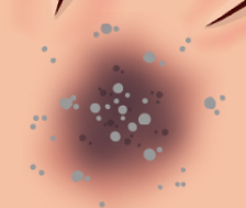 Cement Burn.png