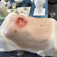 Prosthetic for Donar's suicide wound