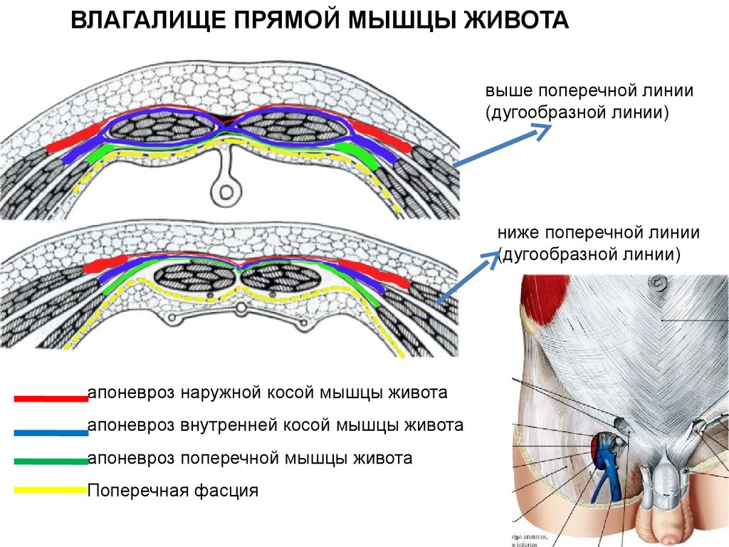 Начало прямой мышцы. Строение влагалища прямой мышцы живота. Влагалище прямой мышцы живота. Белая линия живота.. Сухожильное влагалище прямой мышцы живота. Влагалище прямой мышцы живота схема.