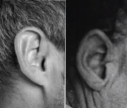 An image comparing a tapered right ear with the Somerton Man's square cut right ear.