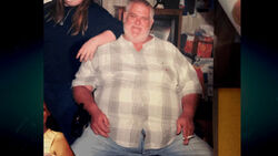 Angry Grandpa Before The underwent gastric bypass surgery