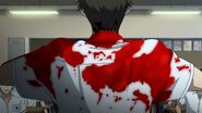 Kubodera bleeding out.jpg (83 KB) Mr. Kubodera's neck begins to bleed out.