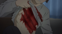 Sakuta wakes up to his signature wounds