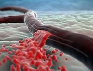 Вн.jpeg (7 КБ) Внутреннее кровотечение